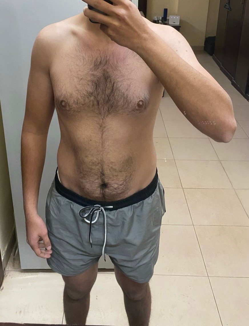 Before transformation